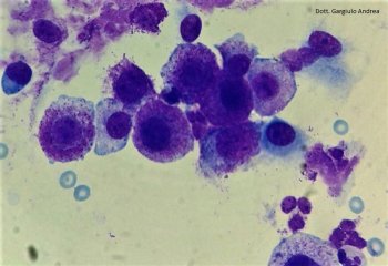 Mastocitoma cutaneo